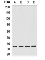 IL-20RB Rabbit Polyclonal Antibody