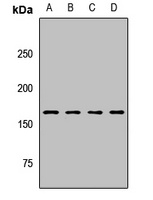 CPS1 Rabbit Polyclonal Antibody