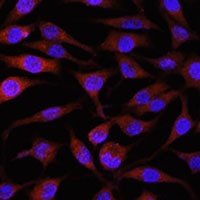 NEDD4L Antibody