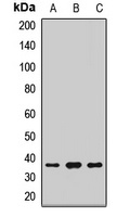 PRPS1 Rabbit Polyclonal Antibody
