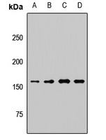 KDM6A Rabbit Polyclonal Antibody