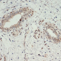 KDM6A Rabbit Polyclonal Antibody
