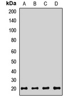 CD160 Rabbit Polyclonal Antibody