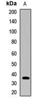 PHF7 Rabbit Polyclonal Antibody