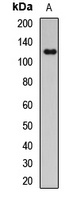 NBS1 Rabbit Polyclonal Antibody