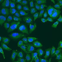 NBS1 Rabbit Polyclonal Antibody