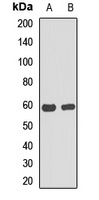 cGAS Rabbit Polyclonal Antibody