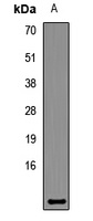 COX7A2 Rabbit Polyclonal Antibody