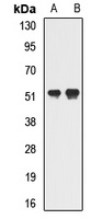 GTF2H4 Rabbit Polyclonal Antibody