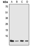 NDUFA7 Rabbit Polyclonal Antibody