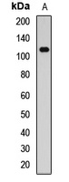 PDE3B Rabbit Polyclonal Antibody