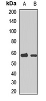 CHRNA6 Rabbit Polyclonal Antibody