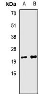 Tim9B Rabbit Polyclonal Antibody