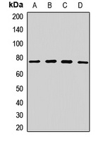 ZNF408 Rabbit Polyclonal Antibody