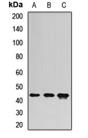 MTERFD3 Rabbit Polyclonal Antibody