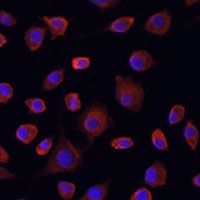 ULK1 Rabbit Polyclonal Antibody