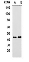 CALCRL Rabbit Polyclonal Antibody