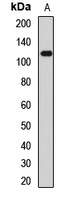 TRPA1 Rabbit Polyclonal Antibody