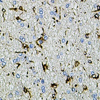 TRPA1 Rabbit Polyclonal Antibody