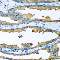 Cytochrome P450 46A1 Rabbit Polyclonal Antibody