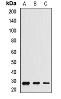 CHCHD3 Rabbit Polyclonal Antibody