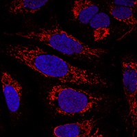 CHCHD3 Rabbit Polyclonal Antibody