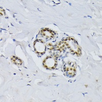 BCCIP Rabbit Polyclonal Antibody