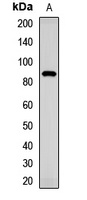 TMC1 Rabbit Polyclonal Antibody