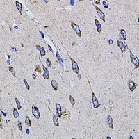 TMC1 Rabbit Polyclonal Antibody