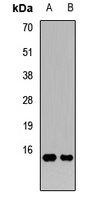 GATC Rabbit Polyclonal Antibody