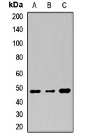TMPRSS11A Antibody