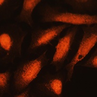 GMF beta Rabbit Polyclonal Antibody