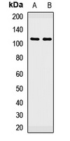 PBXIP1 Rabbit Polyclonal Antibody