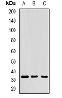 RPIA Rabbit Polyclonal Antibody