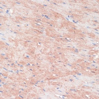 RPIA Rabbit Polyclonal Antibody