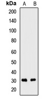 SNRPB2 Rabbit Polyclonal Antibody