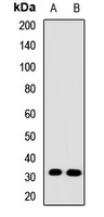 GPM6A Rabbit Polyclonal Antibody