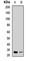 EXOSC4 Rabbit Polyclonal Antibody