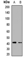 RAI1 Rabbit Polyclonal Antibody