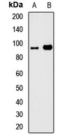 GTF3C4 Rabbit Polyclonal Antibody