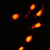 GTF3C4 Rabbit Polyclonal Antibody