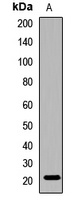 Gamma-C-crystallin Rabbit Polyclonal Antibody