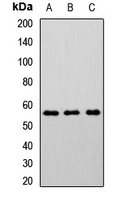 CHRNB2 Rabbit Polyclonal Antibody