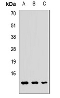 GUCA2A Rabbit Polyclonal Antibody
