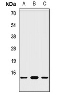 NDUFA6 Rabbit Polyclonal Antibody