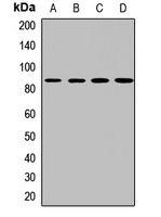 PTK7 Rabbit Polyclonal Antibody