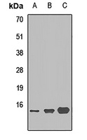MRP14 Rabbit Polyclonal Antibody