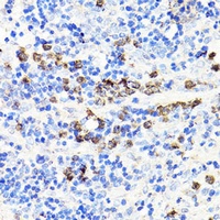 MRP14 Rabbit Polyclonal Antibody