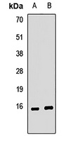 KCNE2 Rabbit Polyclonal Antibody