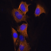 ATP1B2 Rabbit Polyclonal Antibody